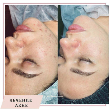 Svetlana Kozhevnikova, New York City Фото - 5