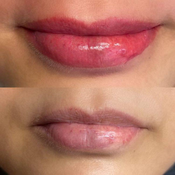 Динара , Нью-Йорк Фото - 5