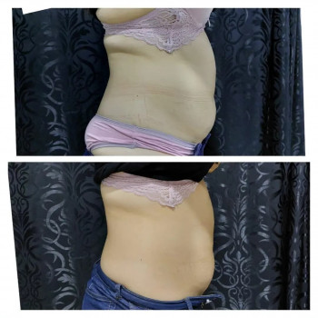 Slim Club, Тараз Фото - 5