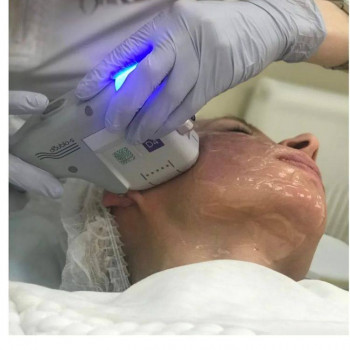 Facial Mesotherapy