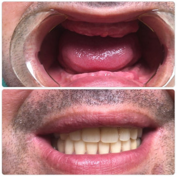 БотаДент, Taraz Фото - 5