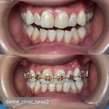 Dental Clinic, Taraz Фото - 1