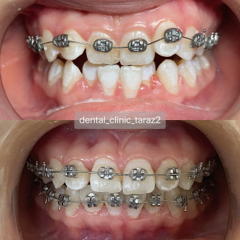 Dental Clinic, Taraz Фото - 4