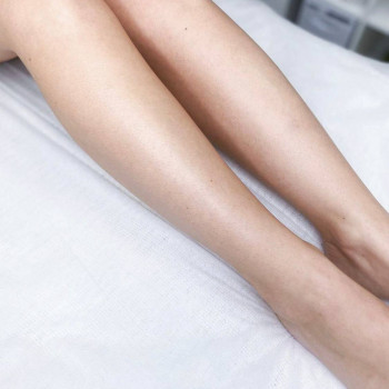 Альбина , Нью-Йорк Фото - 5