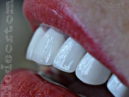 Стоматологическая клиника Медео Павлодар,​Торайгырова, 26