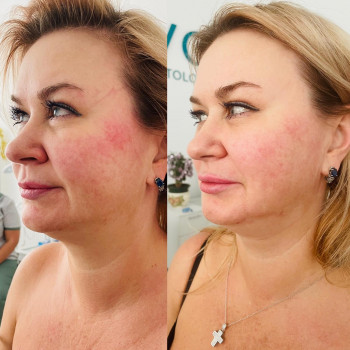 Один сеанс массажа Health Touch