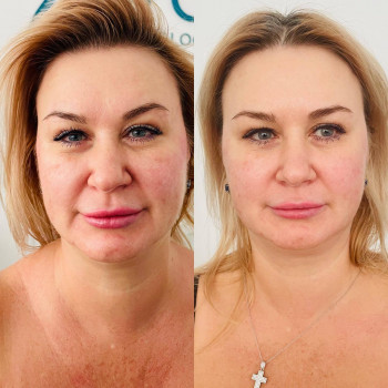 Один сеанс массажа Health Touch