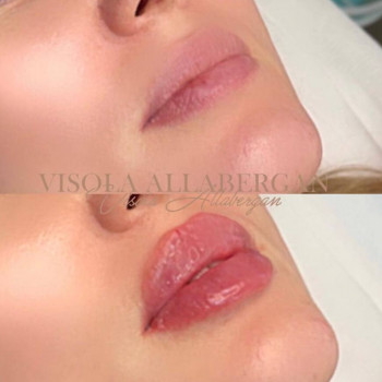 Balance, Нью-Йорк Фото - 5