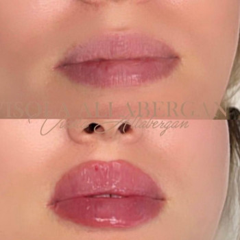 Balance, Нью-Йорк Фото - 7