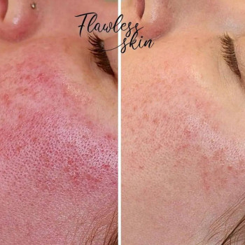 Flawless skin, Warsaw Фото - 6