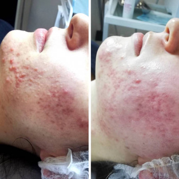 Emiliya , Warsaw Фото - 5