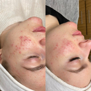 Анна Приходько, Варшава Фото - 12