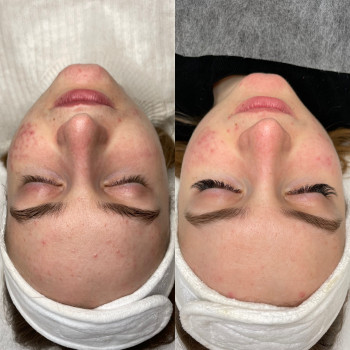 Анна Приходько, Варшава Фото - 14