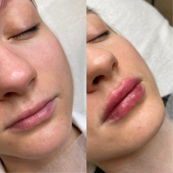 Анна Приходько, Варшава Фото - 15