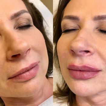 Анна Приходько, Варшава Фото - 18