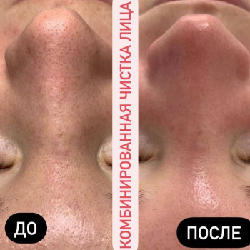 Liliana , Warszawa Фото - 5