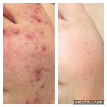 Kristina , Warsaw Фото - 5