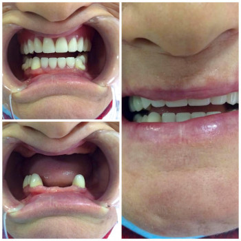 Aru Stom, Атырау Фото - 5