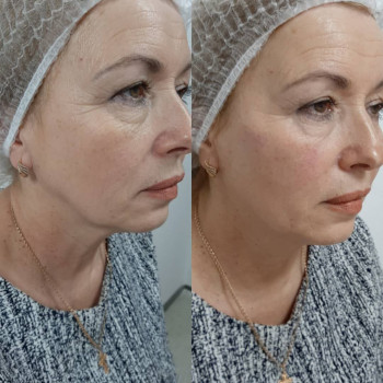 Лидия , Варшава Фото - 5