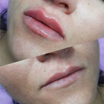 Лидия , Варшава Фото - 6