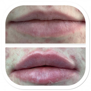 Leona, Варшава Фото - 5