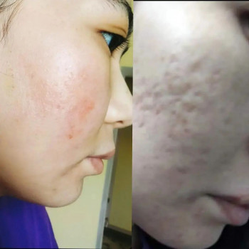 Ляззат Рысмухан, Atyrau Фото - 5