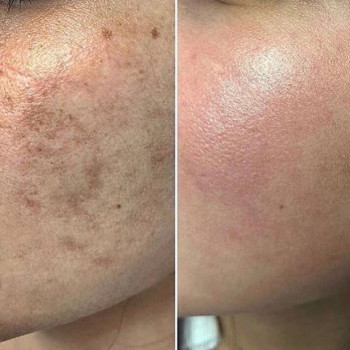 Гуляйм , Atyrau Фото - 5