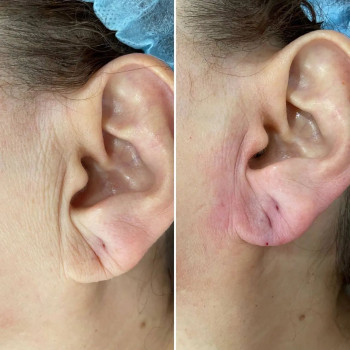 Ирина Бакирова, Атырау Фото - 5