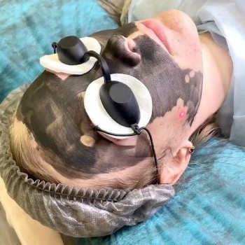 Альгинатная маска
