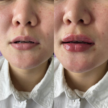 Ясмина , Атырау Фото - 5