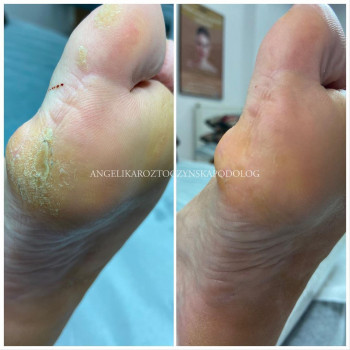 Anzhelika , Warszawa Фото - 5