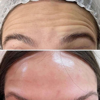 Жадра , Семей Фото - 5