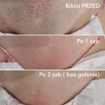 Studio Laser, Варшава Фото - 5