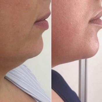 Милена Месропян, Samara Фото - 6