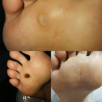 Izabela Olender, Wroclaw Фото - 5