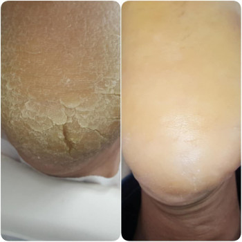 Elena , Wroclaw Фото - 5