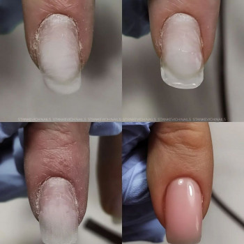 Укрепление ногтей биогелем