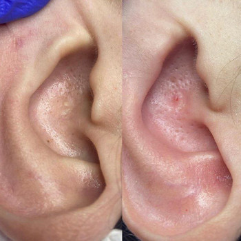 Yana Rybalka, Poznan Фото - 5