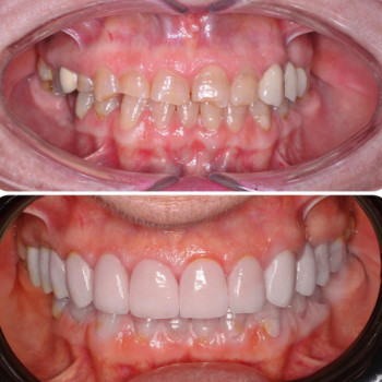 Dariush Rydz, Warsaw Фото - 5