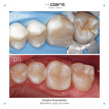 Dmitriy Kravchenko, Krakow Фото - 5