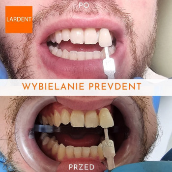 Lardent, Krakow Фото - 5