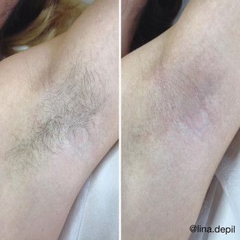 Lina , Lodz Фото - 5