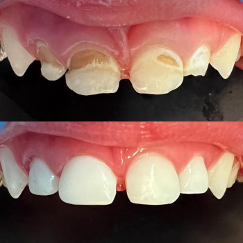 Mikhal Kachmarek, Warsaw Фото - 6