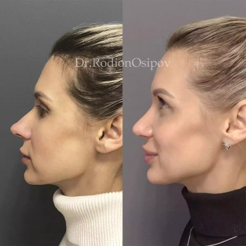 Родион Владимирович Осипов, Санкт-Петербург Фото - 5