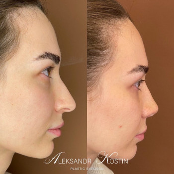 Александр Павлович Костин, Moscow Фото - 5