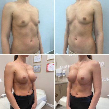 Эдуард Геннадьевич Шумахер, Moscow Фото - 5