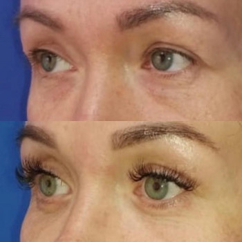 Георгий Эдуардович Карапетян, Moscow Фото - 5