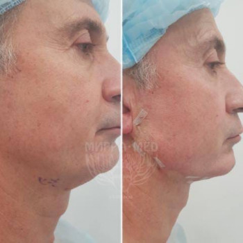 МирраМед, Saint Petersburg Фото - 5