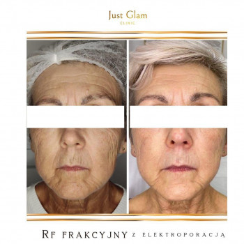 Justglam clinic, Lublin Фото - 5