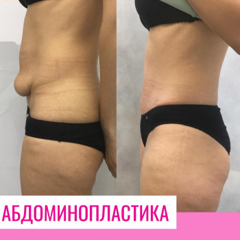 Александра Николаевна Морозова, Yekaterinburg Фото - 5